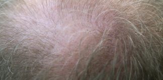 haarproblemen oplossen